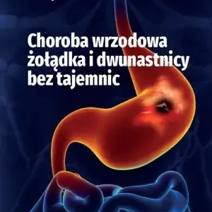 Choroba wrzodowa żołądka i dwunastnicy bez tajemnic