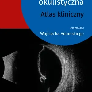 Ultrasonografia okulistyczna. Atlas kliniczny